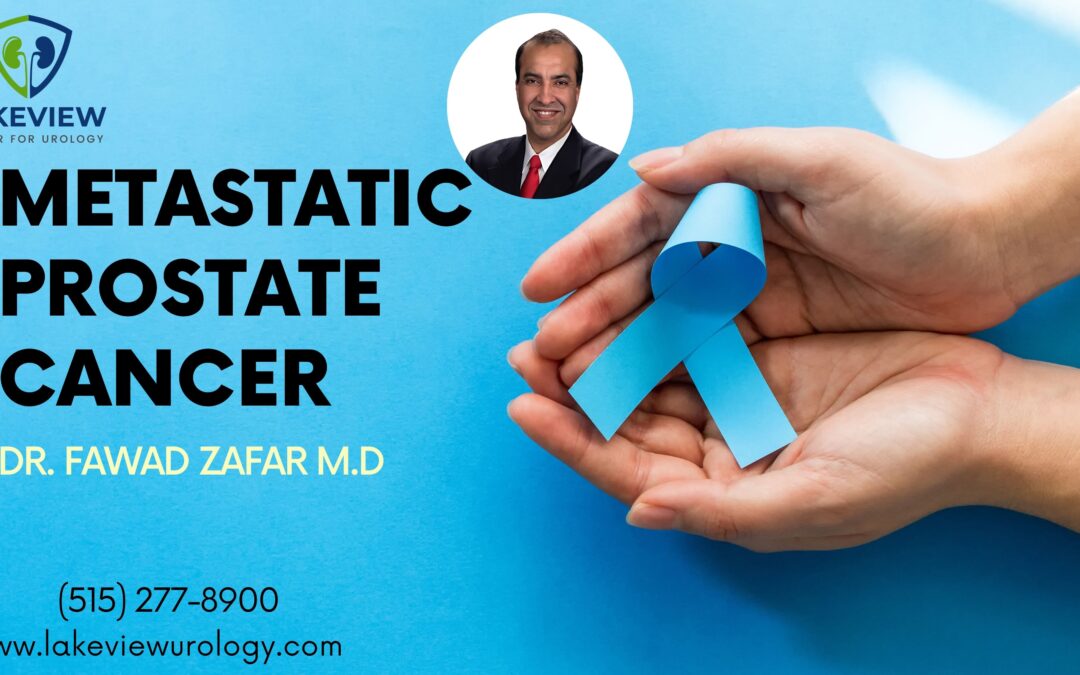 Metastatic Prostate Cancer: Understanding the Journey and Treatment Options