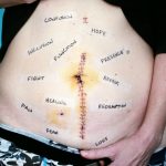 The Ultimate Guide to Vasectomy: Separating Fact from Fiction