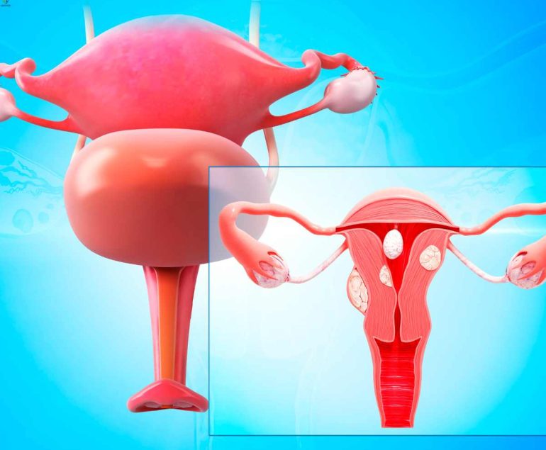All You Need to Know About Cancer of the Bladder