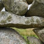 The Ultimate Guide to Kidney Stones: Causes, Symptoms, Treatment, and Prevention