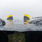 Taking Control of Your Bladder: A Comprehensive Guide to Managing Overactive Bladder