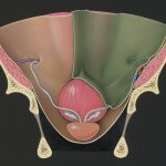 The Enlarged Prostate Epidemic: Understanding Benign Prostatic Hyperplasia and Taking Control of Your Health