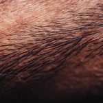 The Ultimate Guide to Vasectomy: Separating Fact from Fiction