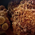 The Silent Killer: Understanding Kidney Disease and Taking Control of Your Health