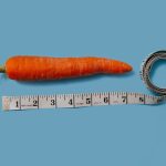 The Ultimate Guide to Prostate Enlargement: Symptoms, Causes, and Treatment Options