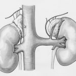 Title: “Understanding Urinary Retention: Causes, Symptoms, Diagnosis & Treatment (A Complete 2024 Guide)”