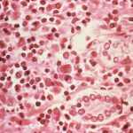 Title: “Beyond the Bladder: A Complete Guide to Benign Prostatic Hyperplasia (BPH) – Causes, Symptoms, Treatments & Everyday Tips for Prostate Health”