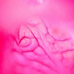 Title: Understanding Benign Prostatic Hyperplasia (BPH): Causes, Symptoms, Diagnosis, and Treatment Options for Men Over 40