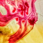 Title: “Understanding Bladder Infections: Causes, Symptoms, Treatment & Proven Prevention Tips”