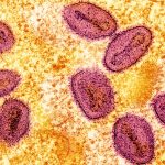 Title: Understanding Hematuria: Causes, Diagnosis, Treatment & What You Can Do Today