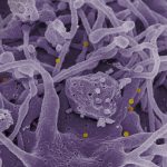 Beyond Prostate Enlargement: Everyday Strategies That Work