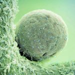 Spotting Blood in Urine: What It Means