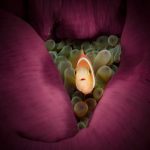 Title: Prostate Cancer Uncovered: Early Signs, Diagnosis, Treatment & Living Well Beyond the Diagnosis